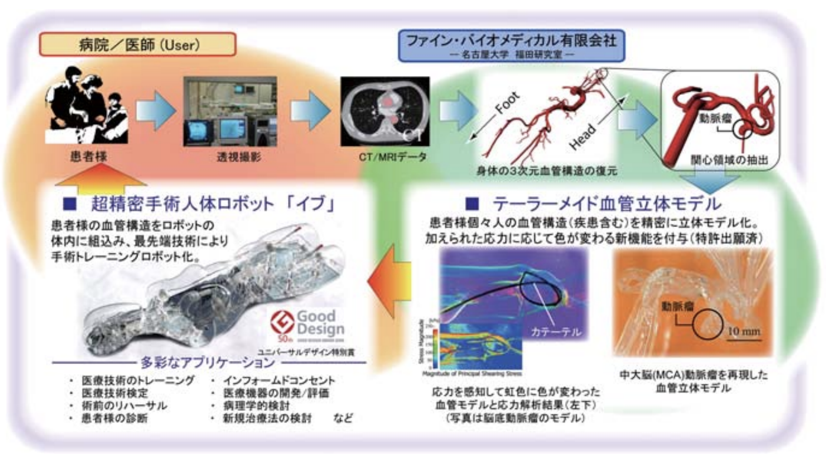 カテーテルを利用した血管内治療普及への期待